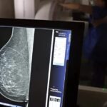 Câncer de mama segue como principal causa de morte por neoplasias entre mulheres na Bahia, diz levantamento